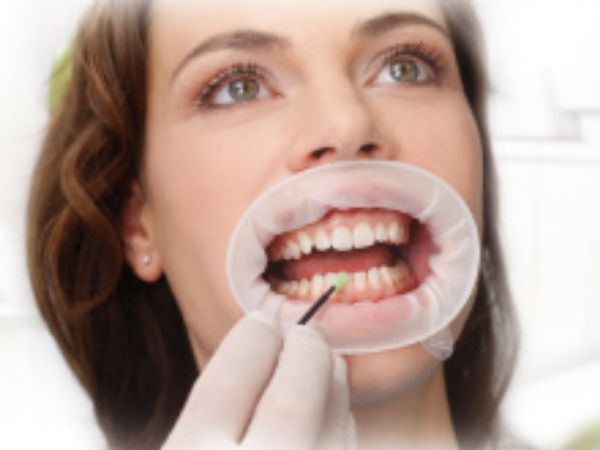 Vivadent OptraGate ramme regular 590850